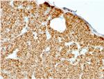 Parathyroid Hormone (PTH) (N-Terminal) Recombinant Mouse Monoclonal Antibody (rPTH, 911)