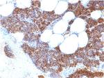 Parathyroid Hormone (PTH) Recombinant Rabbit Monoclonal Antibody (PTH/2295R)