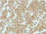 Parathyroid Hormone (PTH) (N-Terminal) Recombinant Rabbit Monoclonal Antibody (PTH, 1717R)