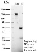 Cycloxygenase-2 (COX-2) Antibody in SDS-PAGE (SDS-PAGE)