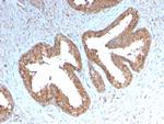 Cycloxygenase-2 (COX-2) Recombinant Rabbit Monoclonal Antibody (COX2/3232R)