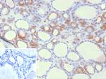 HEG1 (Marker of Malignant Mesothelioma) Monoclonal Antibody (HEG1/9445)