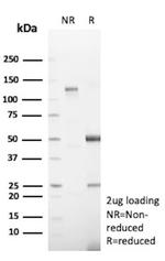 HEG1 (Marker of Malignant Mesothelioma) Antibody in SDS-PAGE (SDS-PAGE)