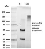 Homeobox and Leucine Zipper Encoding/HOMEZ Antibody in SDS-PAGE (SDS-PAGE)