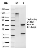 Homeobox and Leucine Zipper Encoding/HOMEZ Antibody in SDS-PAGE (SDS-PAGE)