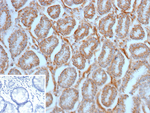 SLAMF7/CS1/CD319 (NK Cell Marker) Antibody in Immunohistochemistry (Paraffin) (IHC (P))
