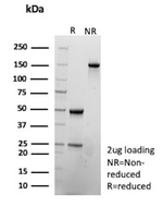 SLAMF7/CS1/CD319 (NK Cell Marker) Antibody in SDS-PAGE (SDS-PAGE)
