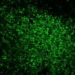 CD45RO (T-Cell Marker) Antibody in Immunohistochemistry (Paraffin) (IHC (P))