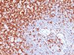 CD45RO (T-Cell Marker) Antibody in Immunohistochemistry (Paraffin) (IHC (P))