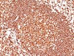 CD45/LCA (Leucocyte Marker) Antibody in Immunohistochemistry (Paraffin) (IHC (P))