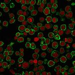 CD45/LCA (Leucocyte Marker) Antibody in Immunocytochemistry (ICC/IF)