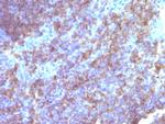 CD45/LCA (Leucocyte Marker) Antibody in Immunohistochemistry (Paraffin) (IHC (P))