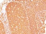 CD45/LCA (Leucocyte Marker) Antibody in Immunohistochemistry (Paraffin) (IHC (P))