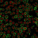 CD45RO (T-Cell Marker) Antibody in Immunocytochemistry (ICC/IF)