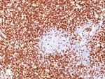 CD45RO (T-Cell Marker) Antibody in Immunohistochemistry (Paraffin) (IHC (P))