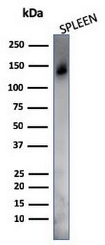CD45RO (T-Cell Marker) Antibody in Western Blot (WB)