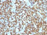 CD45RO (T-Cell Marker) Antibody in Immunohistochemistry (Paraffin) (IHC (P))