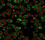 CD45/LCA (B-Cell Marker) Antibody in Immunocytochemistry (ICC/IF)