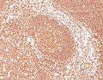 CD45/LCA (B-Cell Marker) Antibody in Immunohistochemistry (Paraffin) (IHC (P))