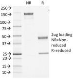 CD45/LCA (B-Cell Marker) Antibody in SDS-PAGE (SDS-PAGE)
