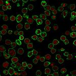CD45/LCA (B-Cell Marker) Antibody in Immunocytochemistry (ICC/IF)