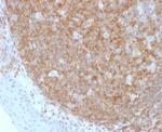 CD45/LCA (B-Cell Marker) Antibody in Immunohistochemistry (Paraffin) (IHC (P))