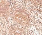 CD45/LCA (B-Cell Marker) Antibody in Immunohistochemistry (Paraffin) (IHC (P))