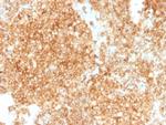 CD45/LCA Antibody in Immunohistochemistry (Paraffin) (IHC (P))