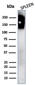 CD45/LCA Antibody in Western Blot (WB)