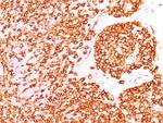 CD45/LCA Antibody in Immunohistochemistry (Paraffin) (IHC (P))