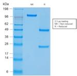 CD45/LCA Antibody in SDS-PAGE (SDS-PAGE)