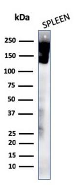 CD45/LCA Antibody in Western Blot (WB)