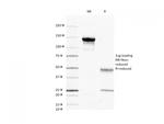 CD45/LCA (B-Cell Marker) Antibody in SDS-PAGE (SDS-PAGE)