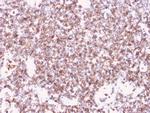 CD45/LCA Antibody in Immunohistochemistry (Paraffin) (IHC (P))