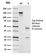 CD45/LCA Antibody in SDS-PAGE (SDS-PAGE)