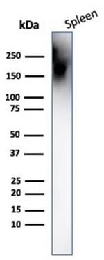 CD45/LCA (B-Cell Marker) Antibody in Western Blot (WB)