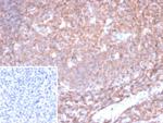 CD45/LCA (B-Cell Marker) Antibody in Immunohistochemistry (Paraffin) (IHC (P))