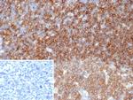 CD45/LCA (B-Cell Marker) Antibody in Immunohistochemistry (Paraffin) (IHC (P))