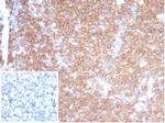 CD45RA/LCA (B-Cell Marker) Antibody in Immunohistochemistry (Paraffin) (IHC (P))