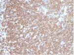 CD45RA/LCA (B-Cell Marker) Antibody in Immunohistochemistry (Paraffin) (IHC (P))