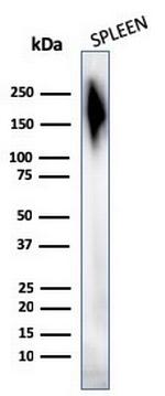 CD45/LCA (Leucocyte Marker) Antibody in Western Blot (WB)