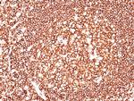 CD45/LCA (Leucocyte Marker) Antibody in Immunohistochemistry (Paraffin) (IHC (P))