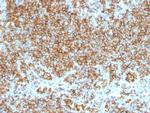 CD45/LCA (Leucocyte Marker) Antibody in Immunohistochemistry (Paraffin) (IHC (P))