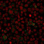 CD45/LCA Recombinant Rabbit Monoclonal Antibody (PTPRC, 1975R)