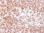 CD45/LCA Antibody in Immunohistochemistry (Paraffin) (IHC (P))