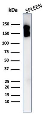 CD45/LCA Antibody in Western Blot (WB)