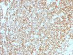 CD45/LCA Antibody in Immunohistochemistry (Paraffin) (IHC (P))