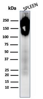 CD45/LCA Antibody in Western Blot (WB)