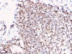 CD45/LCA Antibody in Immunohistochemistry (Paraffin) (IHC (P))