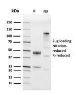 CD45/LCA Antibody in SDS-PAGE (SDS-PAGE)